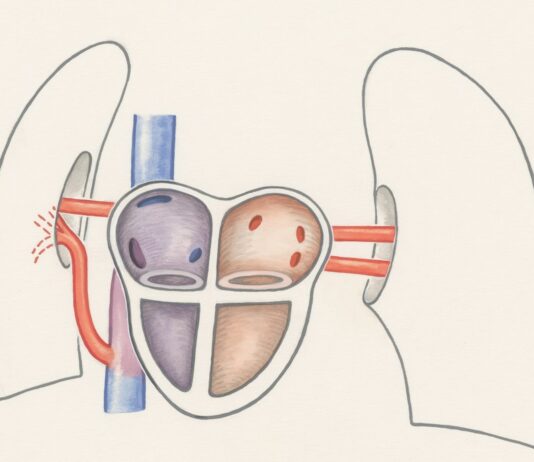 “손발이 늘 차가워요”… 그냥 체질인 줄 알았던 ‘혈액순환 장애’ a drawing of a diagram of the kidney