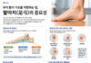 우리 몸의 기초를 지탱하는 힘, 발아치(足弓)의 중요성