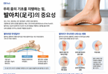 우리 몸의 기초를 지탱하는 힘, 발아치(足弓)의 중요성