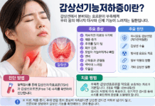 계속 피곤하고 살이 찐다면? 놓치기 쉬운 갑상선기능저하증